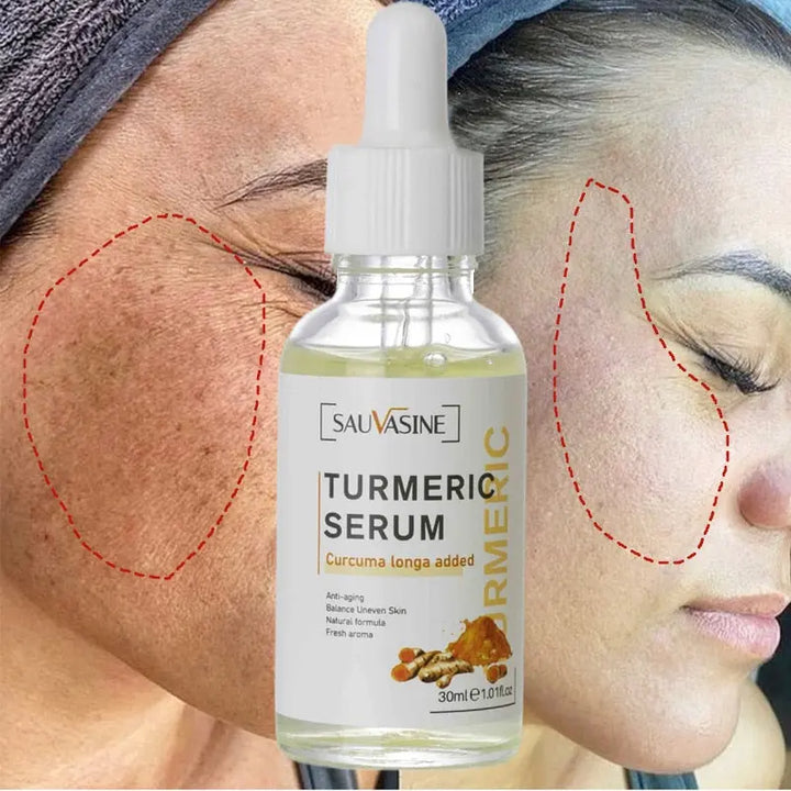 Turmeric Face Whitening Serum - Zera