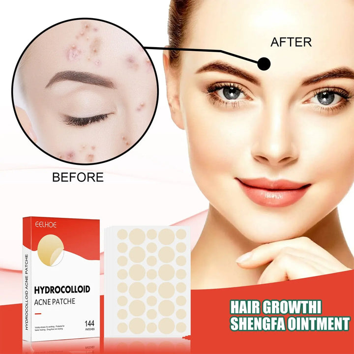 Hydrocolloid Acne Patch - Zera