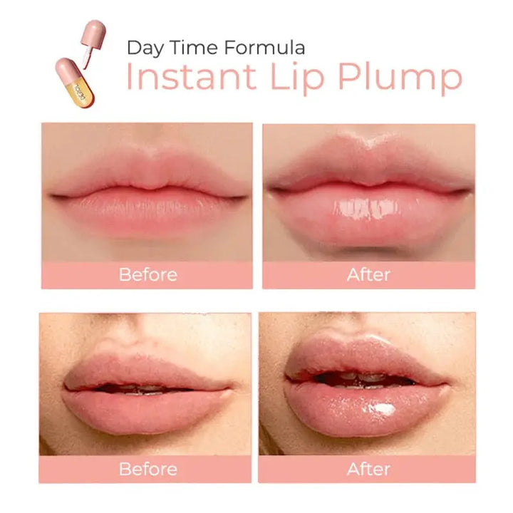 DEROL™ Lip Plumper Kit - Zera