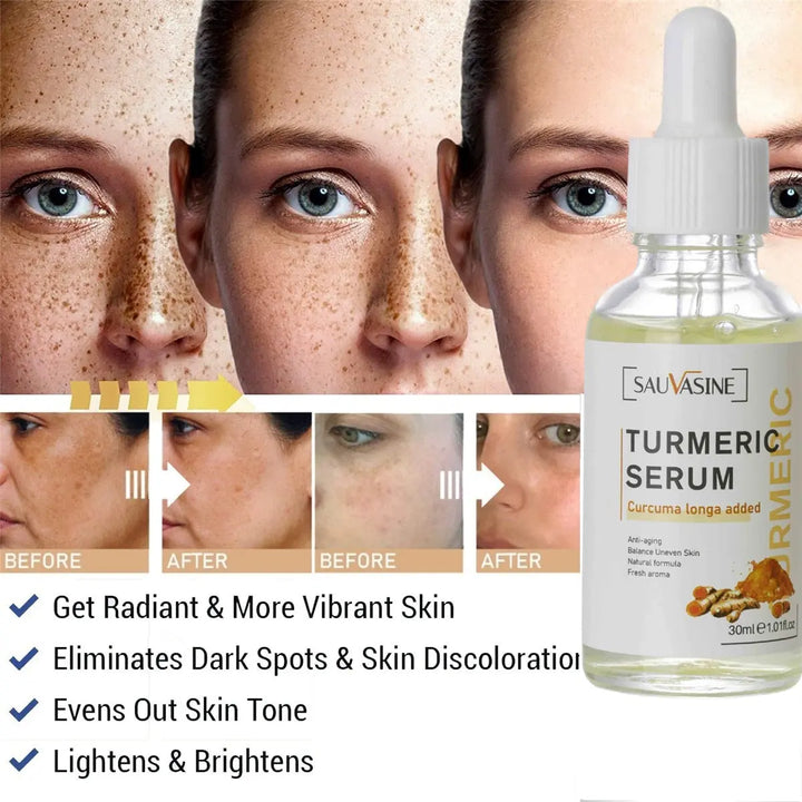 Turmeric Face Whitening Serum - Zera