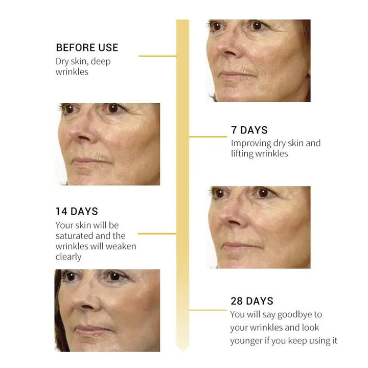 a woman's face before and after wrinkles