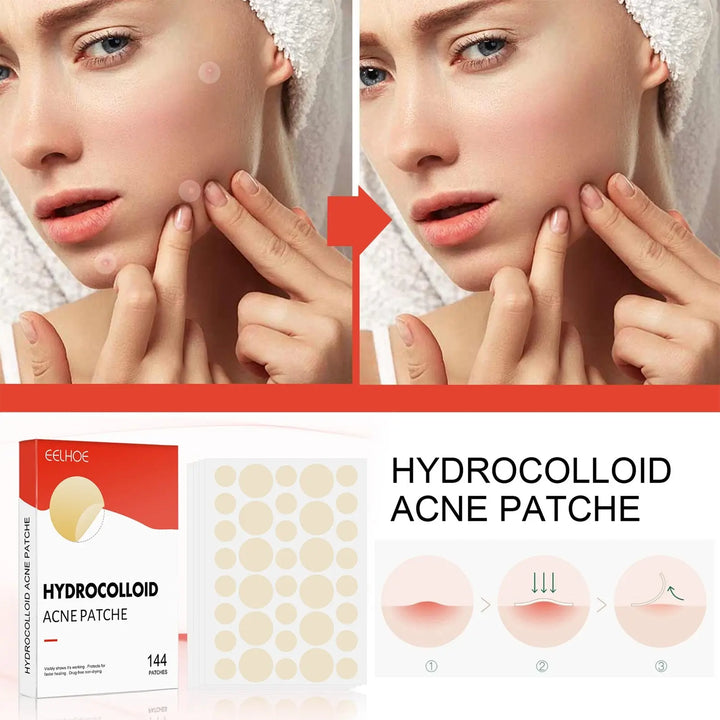 Hydrocolloid Acne Patch - Zera