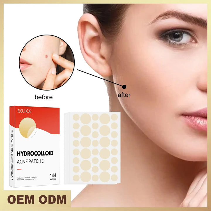 Hydrocolloid Acne Patch - Zera