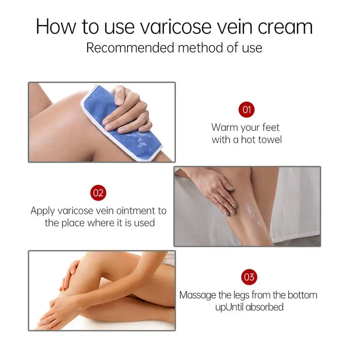 how to use varicose vein cream