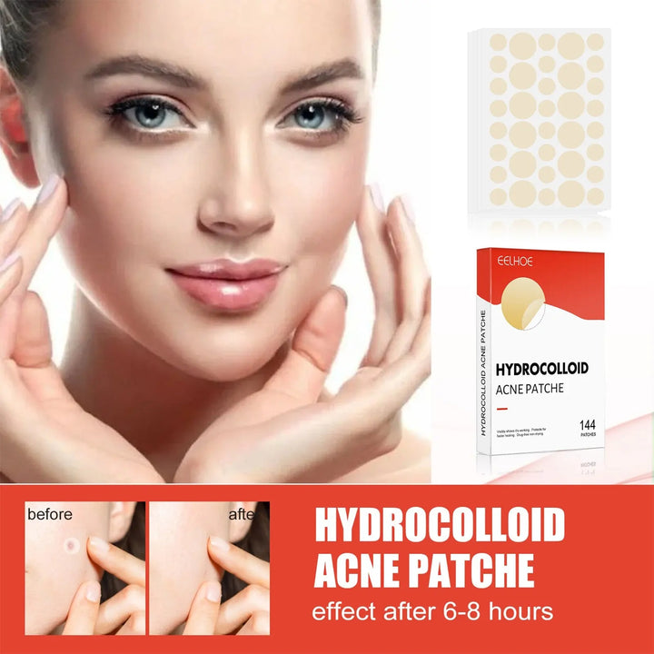 Hydrocolloid Acne Patch - Zera