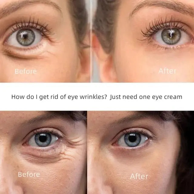 New Anti-Wrinkle Eye Cream - Zera